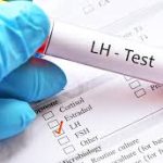 FSH & LH Evaluation, Serum FSH & LH Evaluation, Serum
