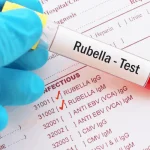 Rubella IgG & IgM, Serum Rubella IgG & IgM, Serum