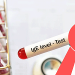 total-ige-test total-ige-test